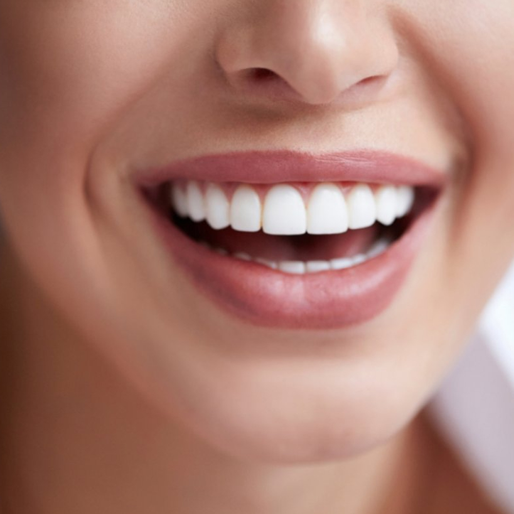 estetik-dis-hekimligi